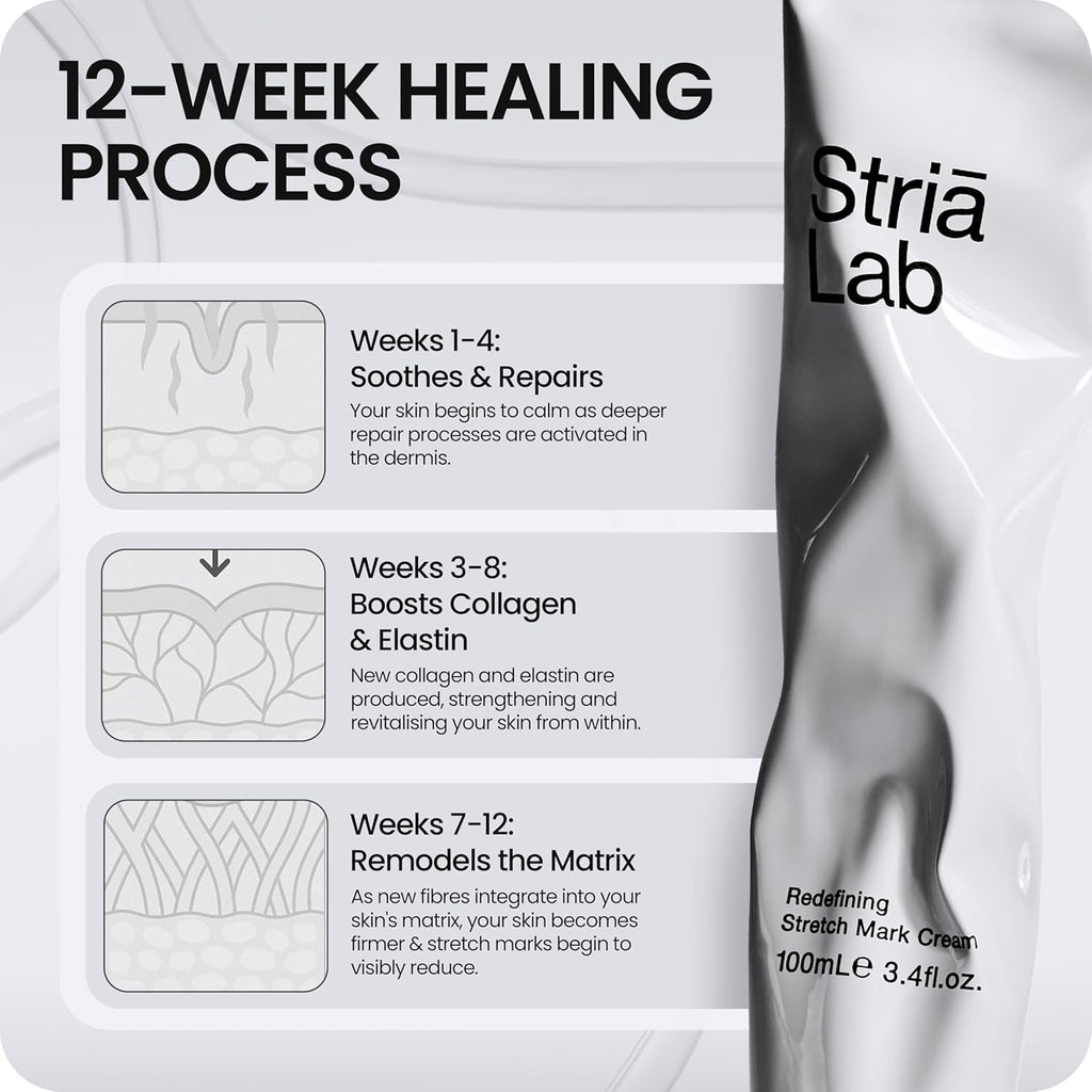 Stretch Mark Repair Programme | 12-Week Kit with Microneedling Tool, Cellular Repair Serum & Redefining Stretch Mark Cream | Clinically Proven to Restore Collagen & Reduce Stretch Marks