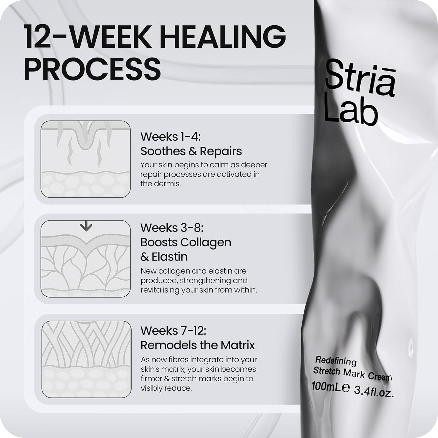 Stretch Mark Repair Programme | 12-Week Kit with Microneedling Tool, Cellular Repair Serum & Redefining Stretch Mark Cream | Clinically Proven to Restore Collagen & Reduce Stretch Marks